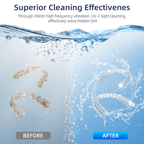Ultrasonic Retainer Cleaner with 200ML Capacity, 45kHz, 4 Modes X16182